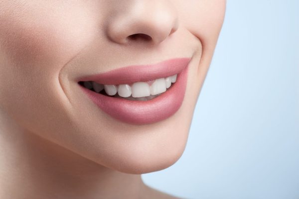 Estética dental